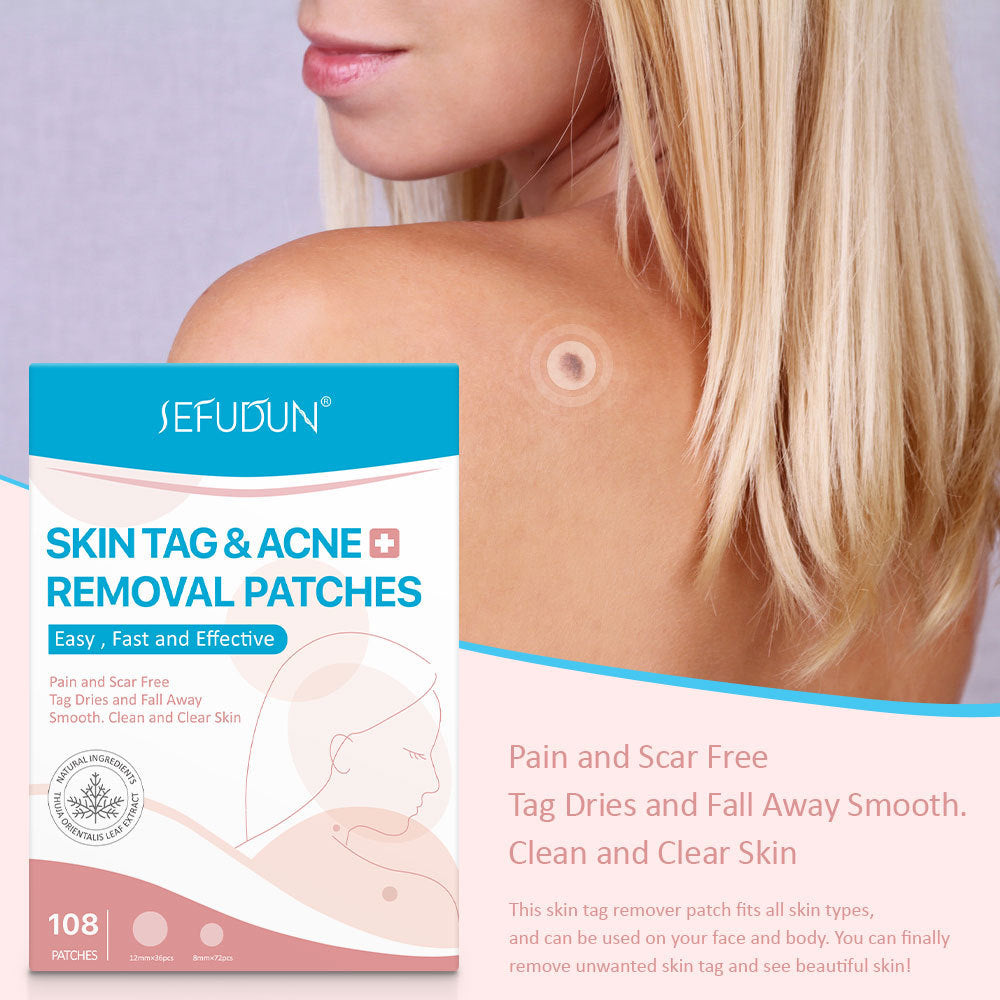 Skin-Tag-Remover